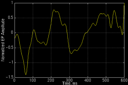 matlab离散信号的短时傅里叶变换_数字信号处理离散傅里叶变换_离散傅里叶变换时域和频域特点