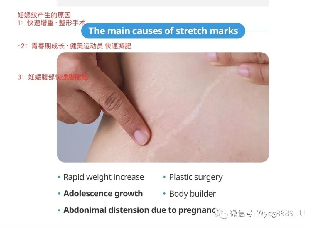 润滑油可以回收吗_润滑剂回收干性废液_回收干性润滑剂