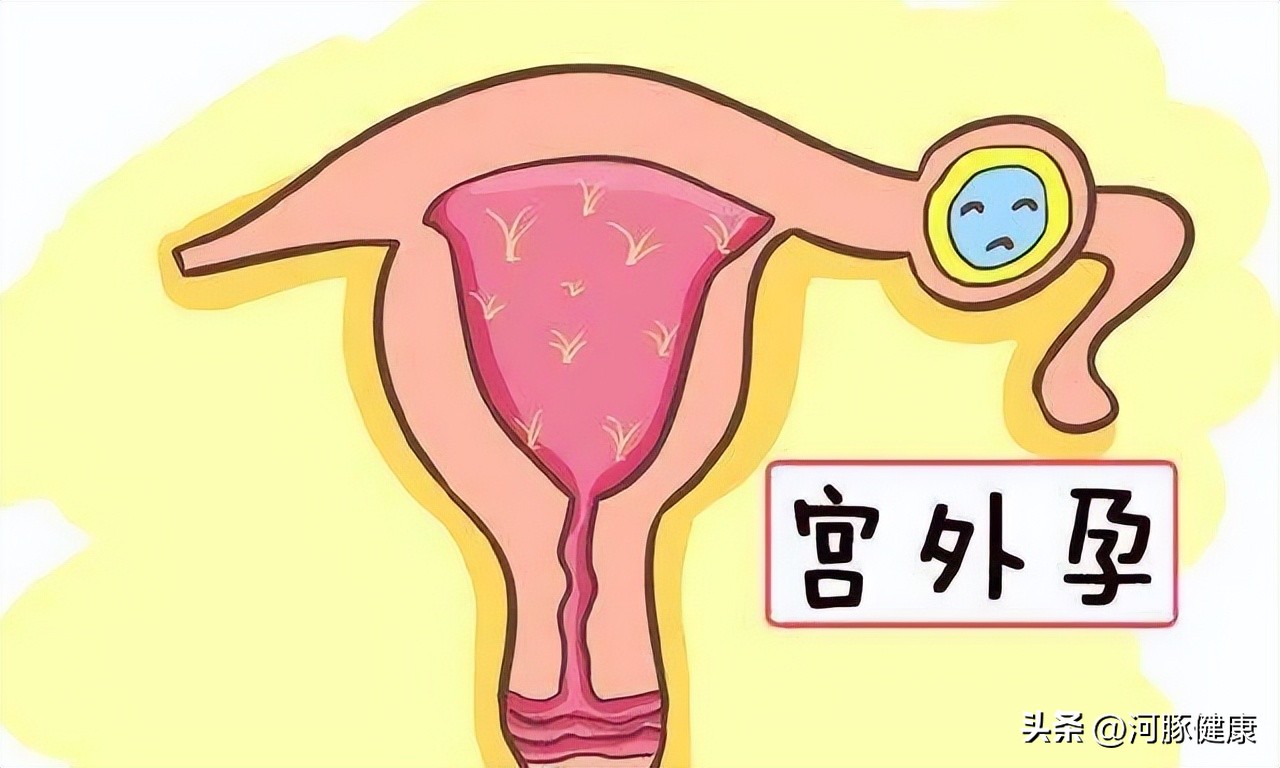 上环白带多怎么办_上环白带多怎么办_上环白带多怎么办