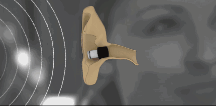 耳机材质过敏耳炎_单耳戴耳机头疼_三星耳机耳部炎症