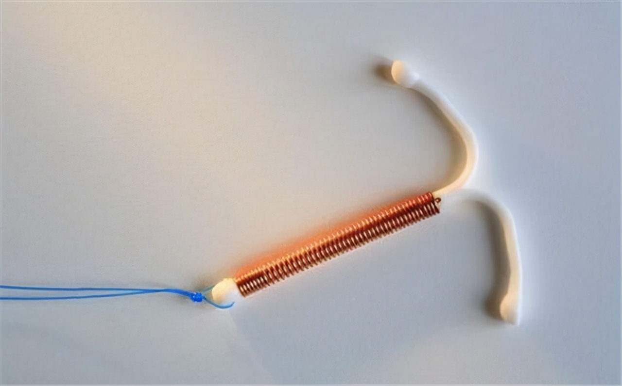 老公不愿意做结扎手术_男性结扎手术安全性_男性结扎与性功能