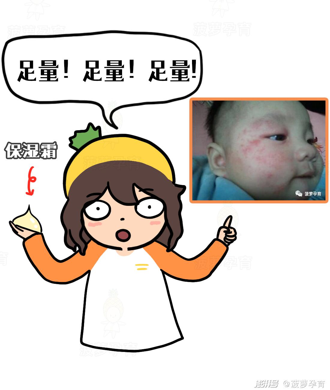 宝宝皮肤问题图谱_湿疹与痱子区别_feng tuan